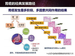 为什么说定期胃镜检查对发现早期胃癌意义重大