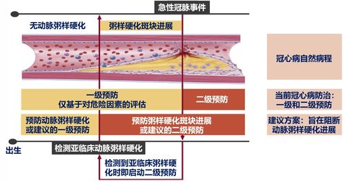 冠状动脉粥样硬化性心脏病治疗理念变迁 从以斑块为中心到以患者为中心